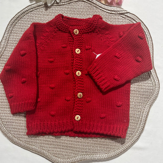Casaco Pompom 6M